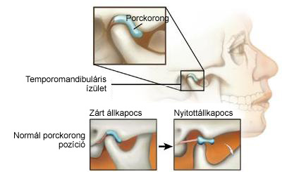 fáj a fül alatti ízület